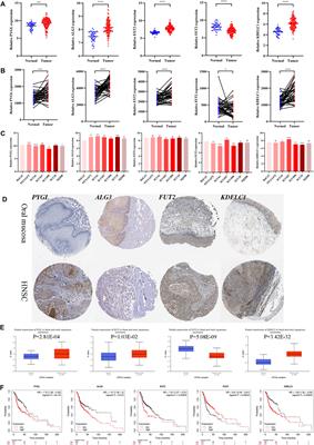 A Glycosyltransferase-Related Signature for Predicting Overall Survival in Head and Neck Squamous Cell Carcinoma